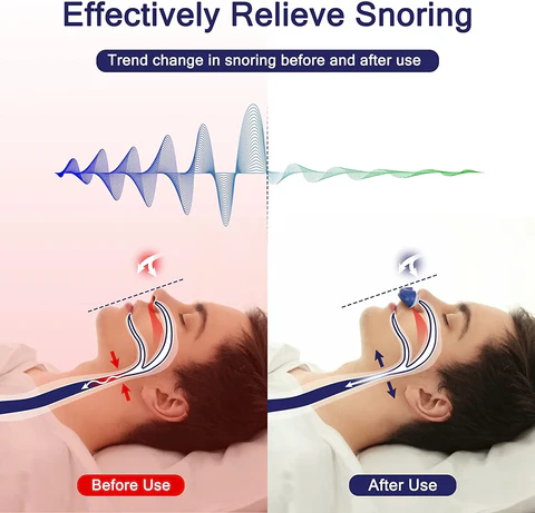 Anti Snoring Nose Clip för Bättre Sömn