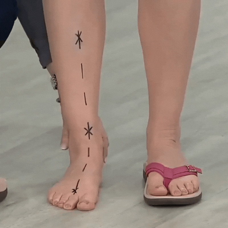 Pylomo Ortopediska Sommarsandaler - Smärtlindring, Fotvalvsstöd och Hållningskorrigering