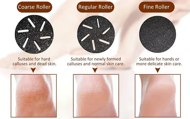 Royaleva Vacuum Callus Remover med uppladdningsbart batteri