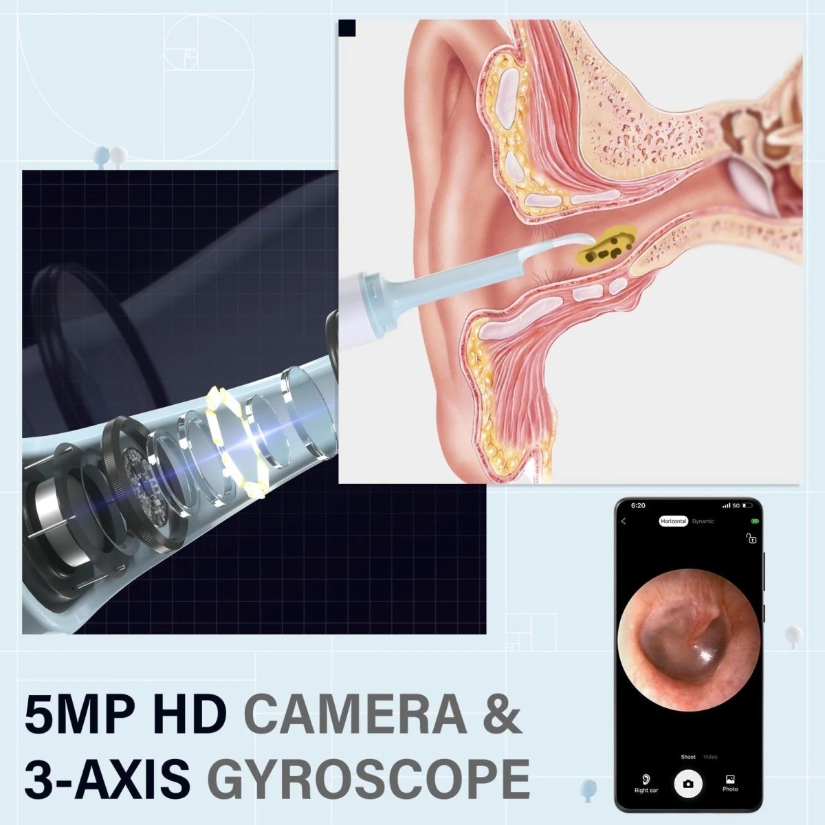 AURIVIEW – Intelligent öronrengörare med HD-kamera