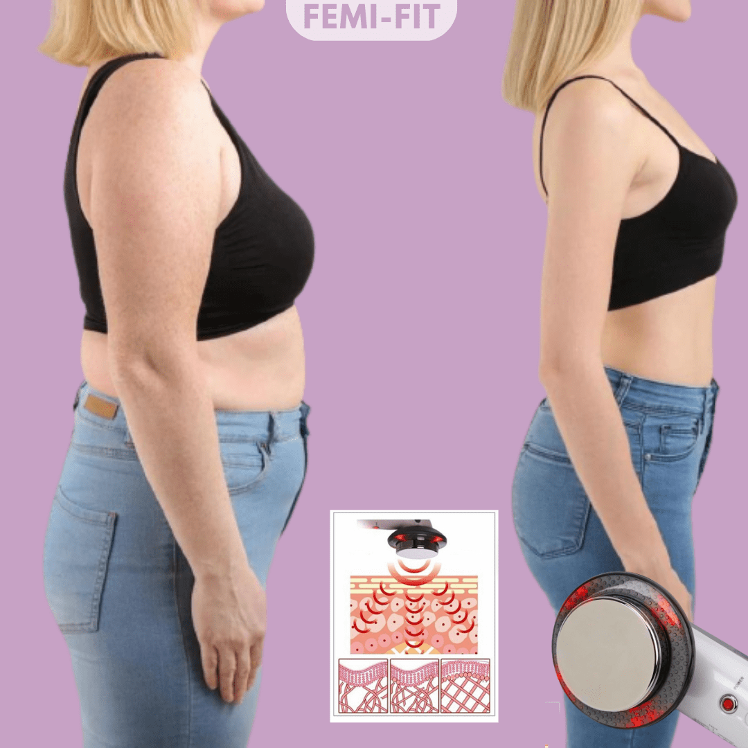 Slimshape - 3-i-1 Cellulite & Fettförbrännare med EMS, Ultraljud & Infraröd