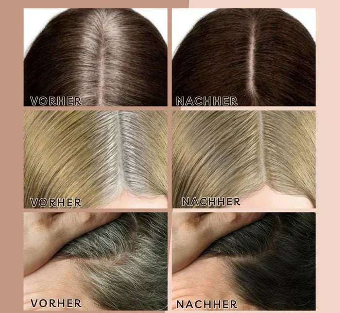 Carvallo – Perfekta hårlinjer när som helst