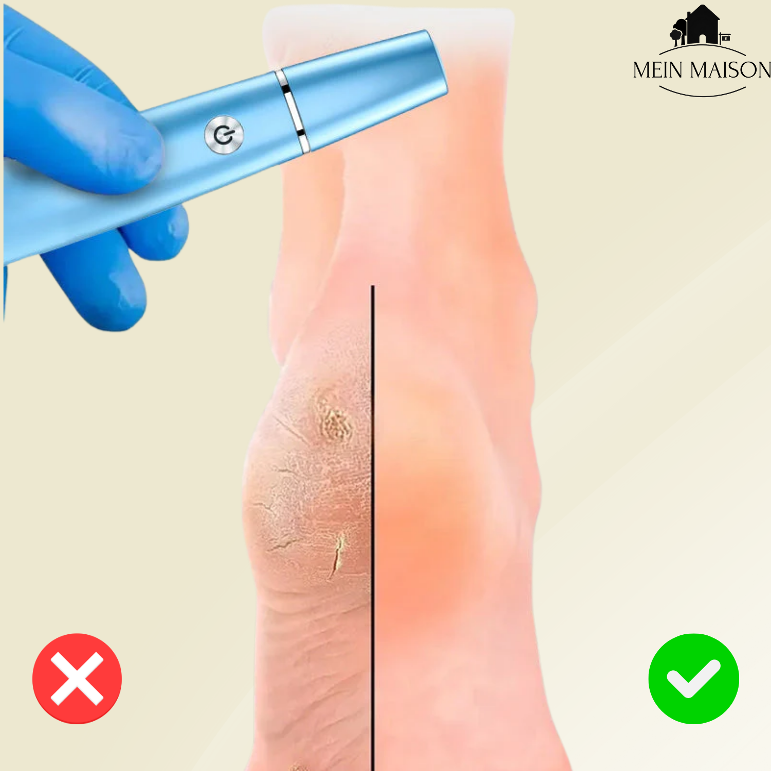 SilkaFeet™ – Lätta släta och välvårdade fötter