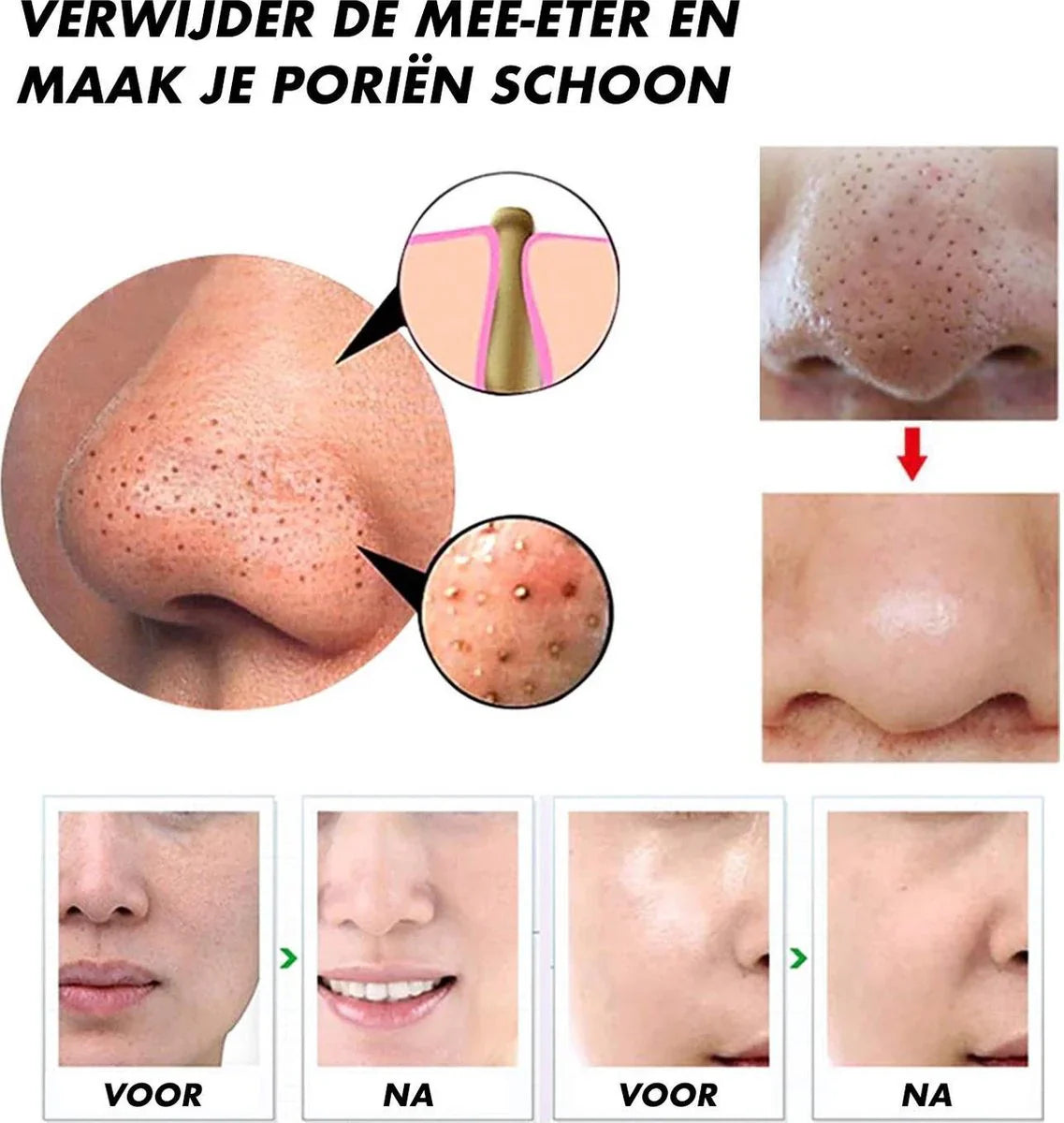 Elektrisk pormaskborttagare