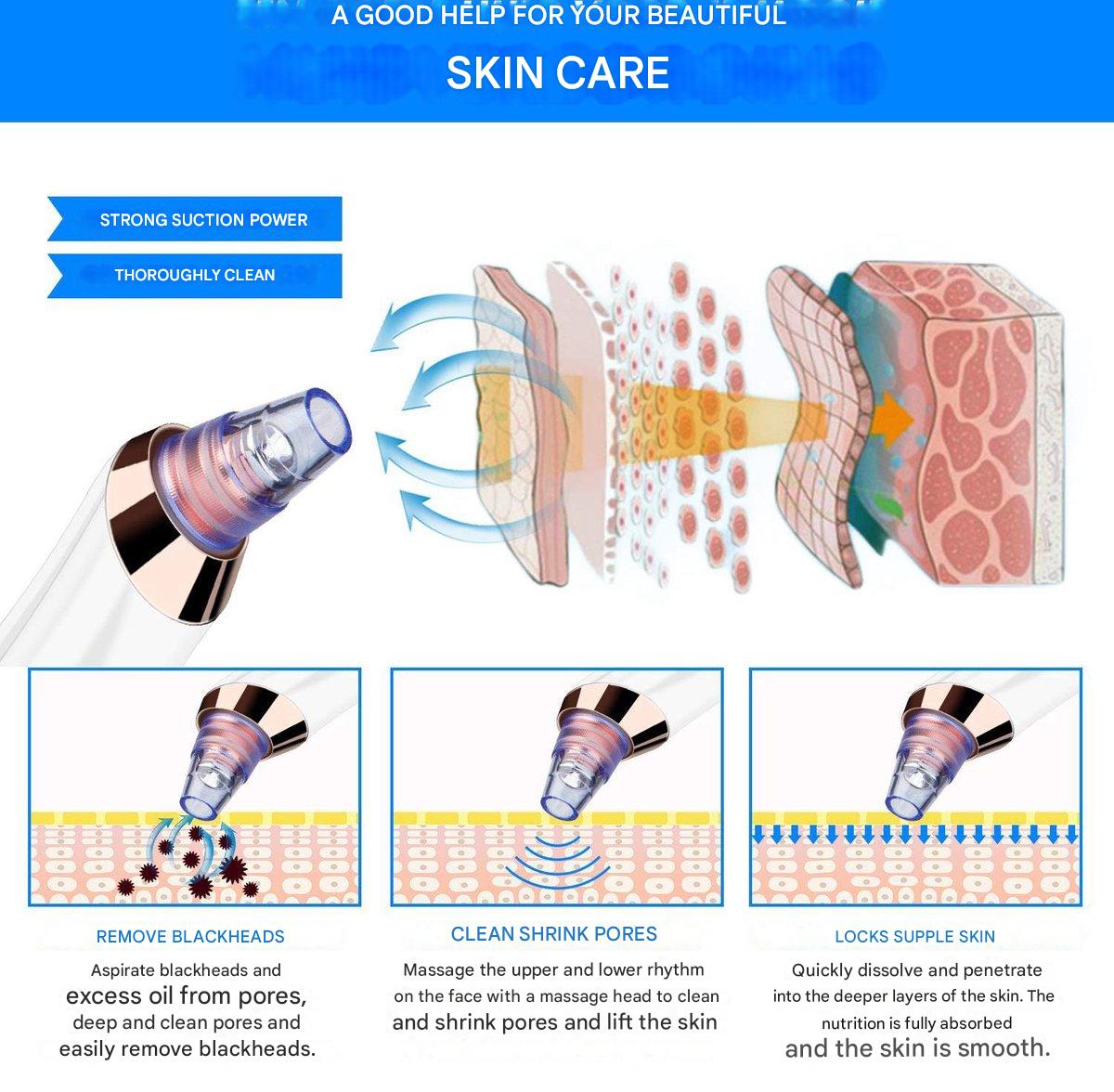 Carvallo PureGlow | Med 5 munstycken | Trådlös & smärtfri | Mot pormaskar & orenheter