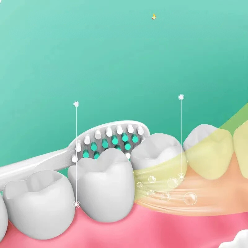 Carvallo Tandborste VibraDent Pure | Batteridriven | 4 Ersatzköpfe | IPX7 Vattentät | Skonsam ultraljudsrengöring