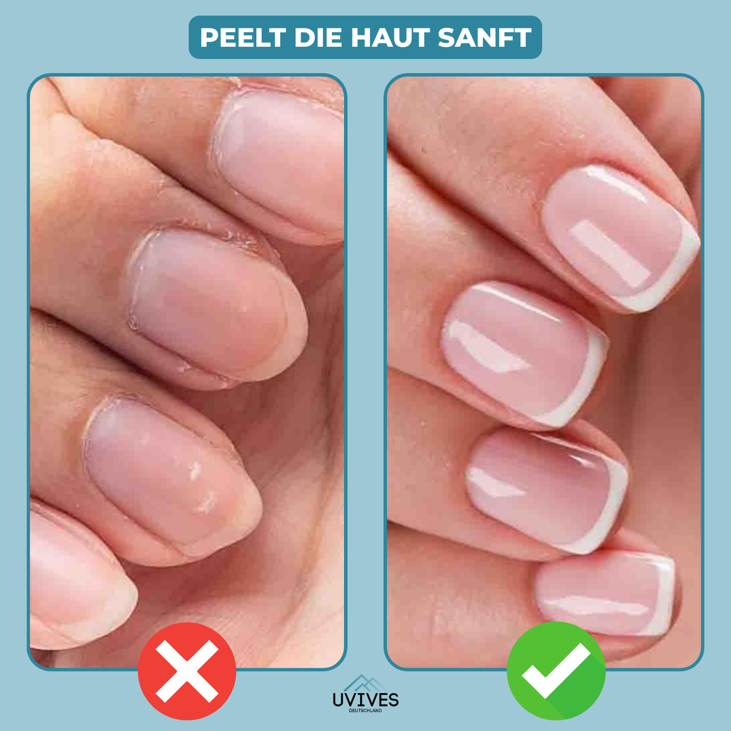 Carvallo | GlossBloom – Den 3-i-1 vårdpennan för strålande vackra naglar!