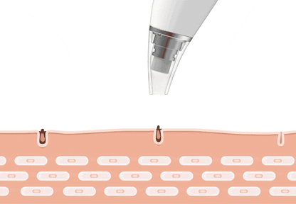 Blackhead Borttagare Vacuum Pore Rengöringsverktyg