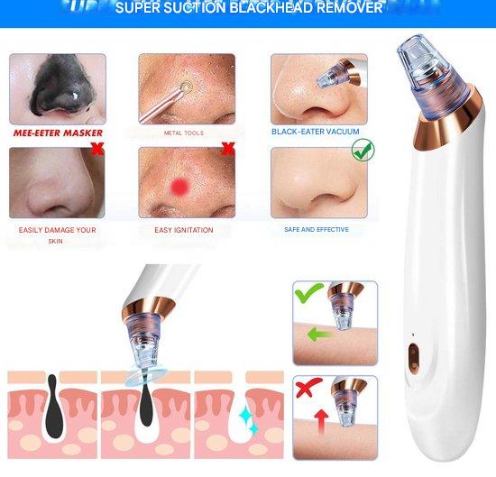 Carvallo PureGlow | Med 5 munstycken | Trådlös & smärtfri | Mot pormaskar & orenheter