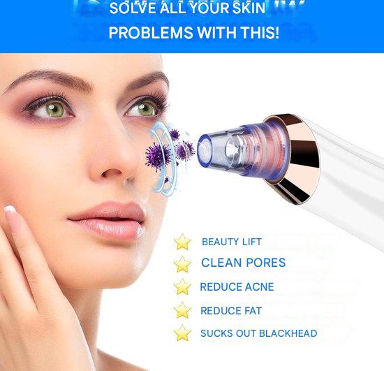 Carvallo PureGlow | Med 5 munstycken | Trådlös & smärtfri | Mot pormaskar & orenheter