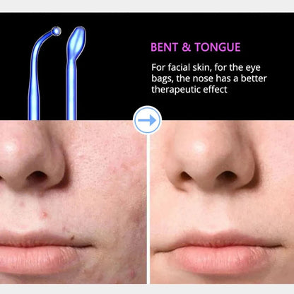 Professionell Högfrekvens Ansikts- &amp; Hårterapi Penna