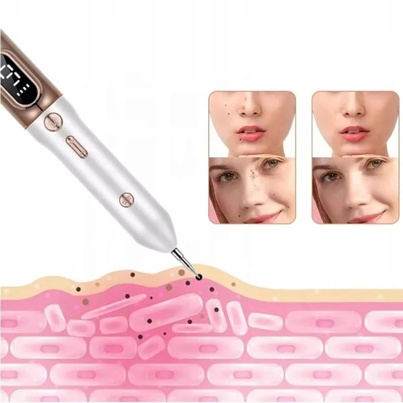 Plasma Pen För Att Ta Bort Hudflikar, Födelsemärken Och Varnande