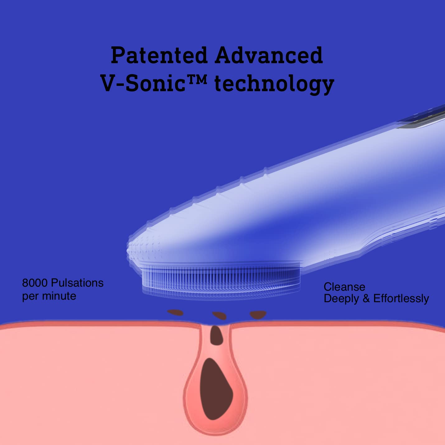 Carvallo GlowSoniq | Vattentät & Återuppladdningsbar | 3-i-1 Peeling, Rengöring & Massage