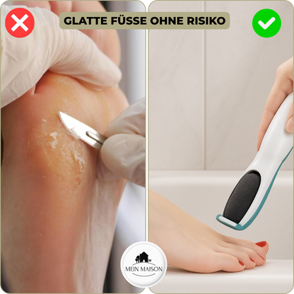 SilkaFeet™ – Lätta släta och välvårdade fötter