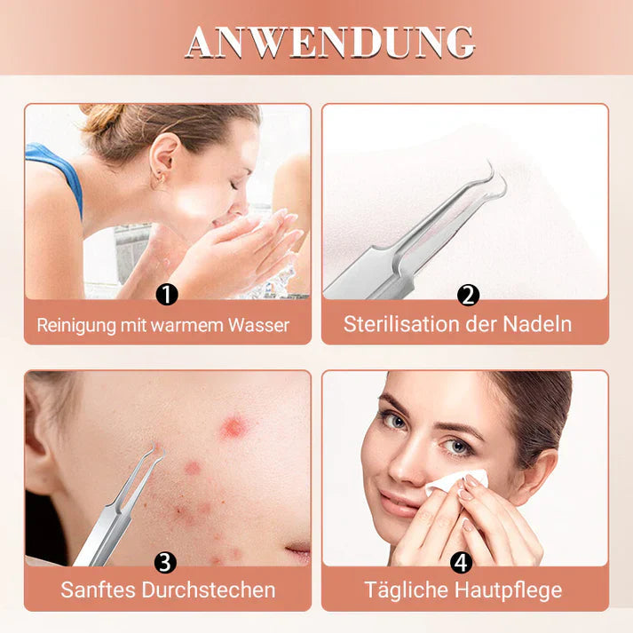 Carvallo Set PureSkinX | Precise & Hygienic | Stainless Steel Tools for Clear Skin