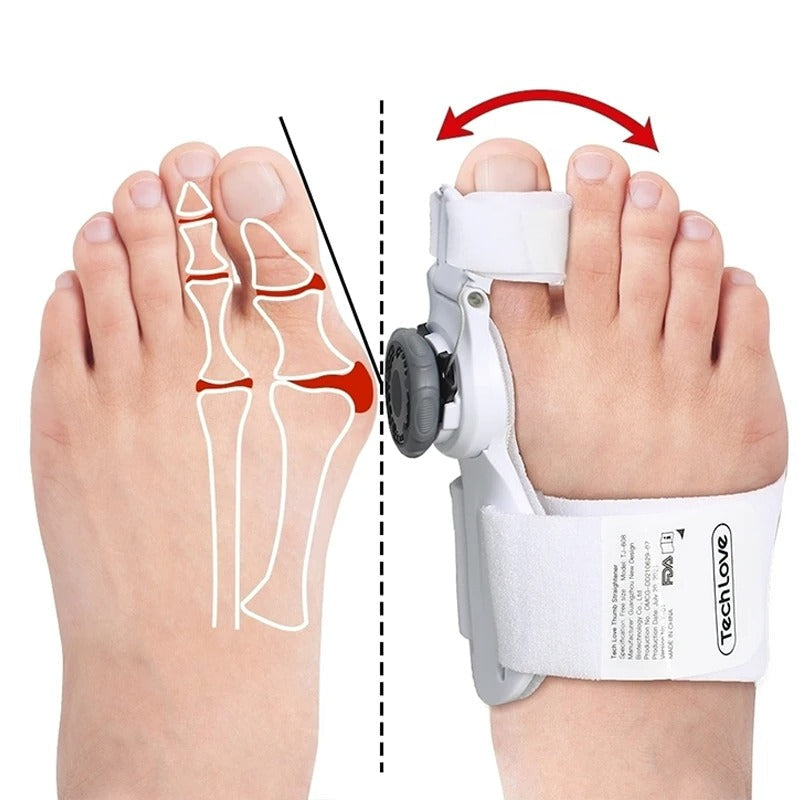 Uppgraderad Tå Bunion Korrigerare – Justerbar Ortopedisk Splint för Smärtlindring &amp; Alignment