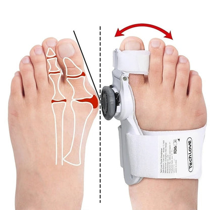 Uppgraderad Tå Bunion Korrigerare – Justerbar Ortopedisk Splint för Smärtlindring &amp; Alignment