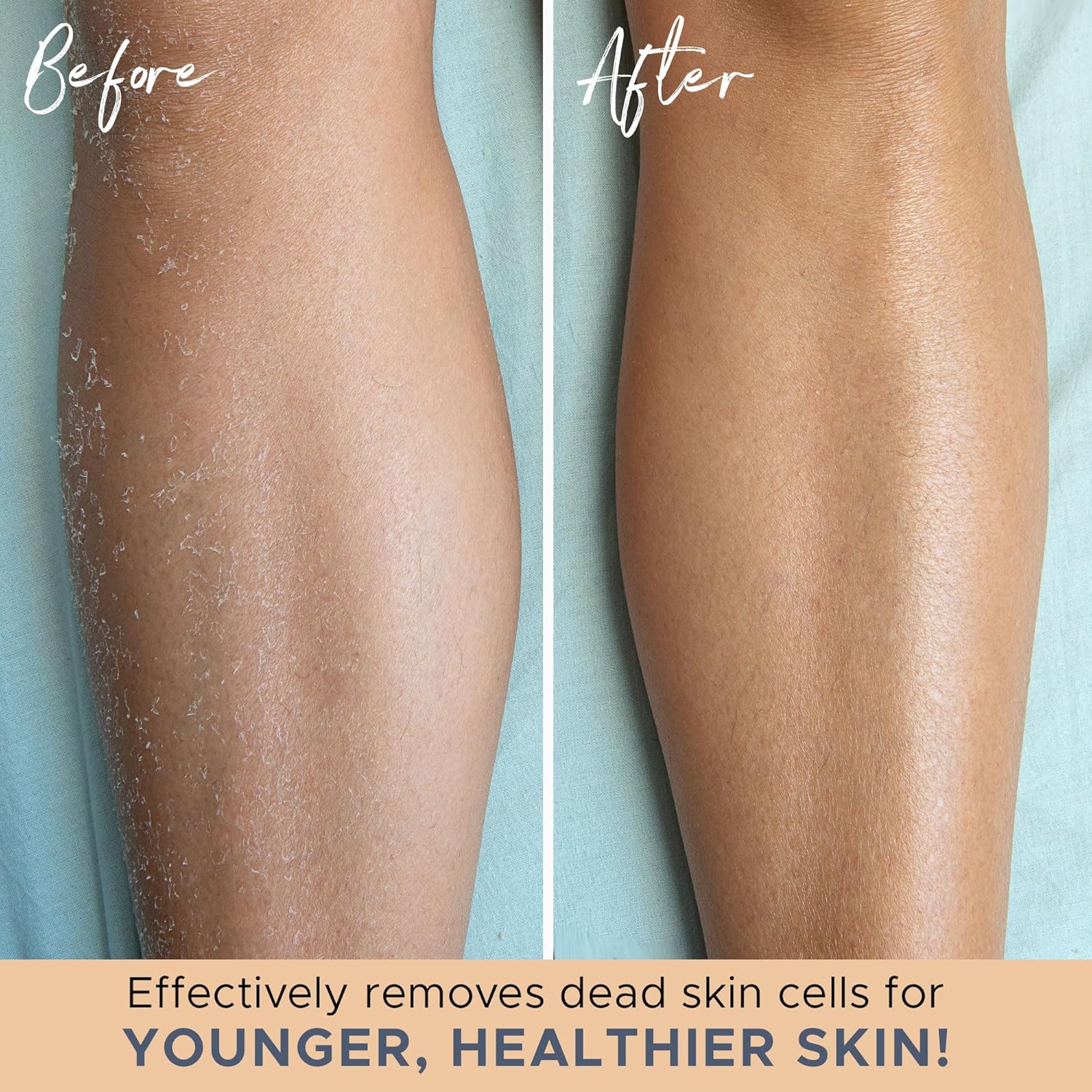 Exfolierande badvantar – 2-pack