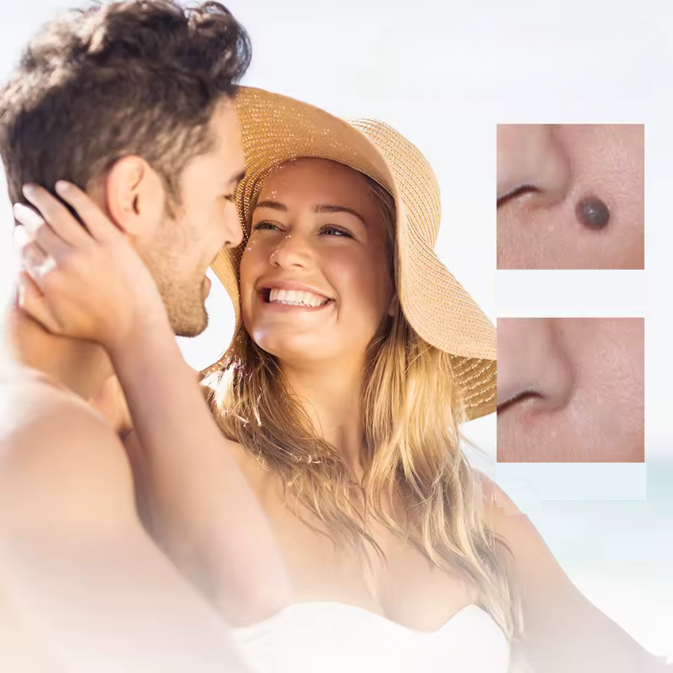 Carvallo – Naturlig vårtorpsavlägsnare