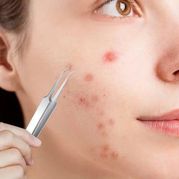 Luxora Svartprick Tång - Anti Svartprick Kit Set 3 Pcs
