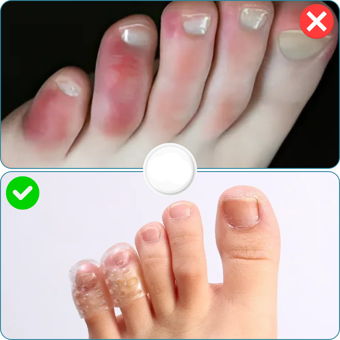 Carvallo | SafeWalk – Gå mjukt, må bättre