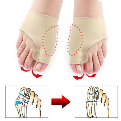 Hallux-Valgus-korrigeringsskydd (1 par)