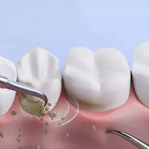 Royaleva Ultraljudsskalare för Hemmabruk