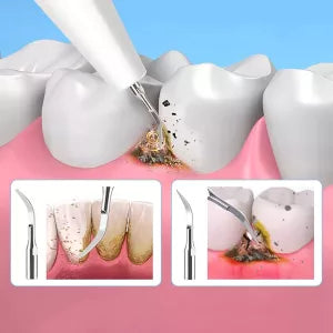 Royaleva Ultraljudsskalare för Hemmabruk