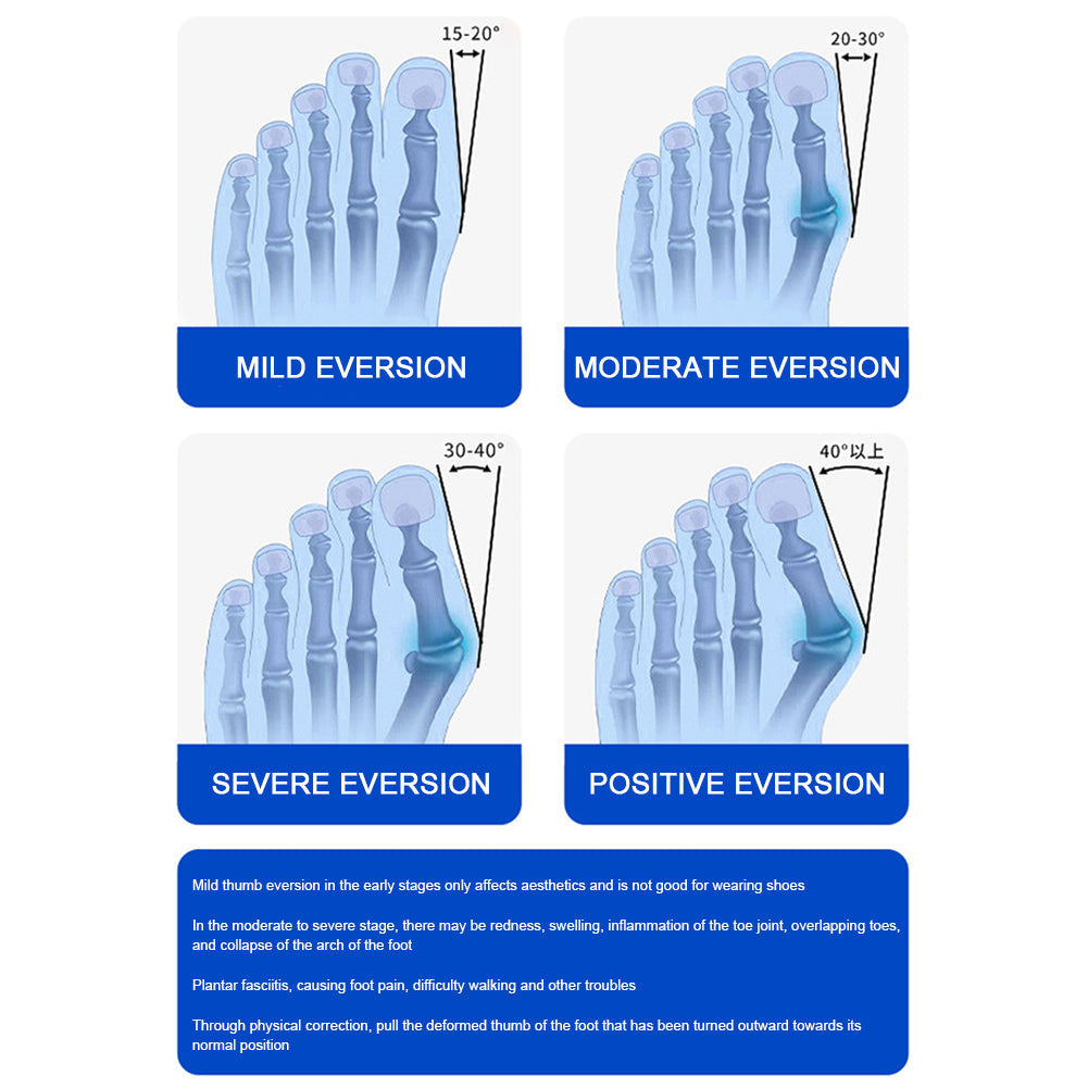 Carvallo – Smärtfri gå utan operation