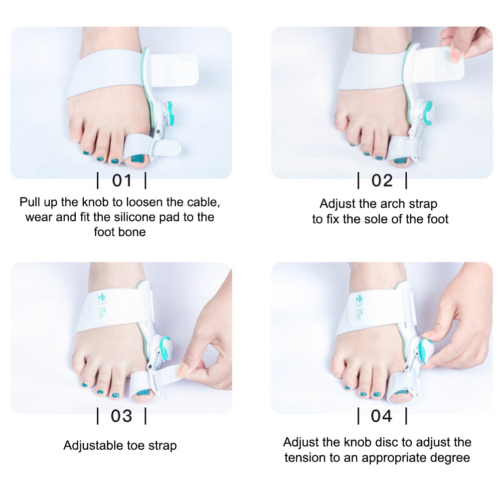 Uppgraderad Tå Bunion Korrigerare – Justerbar Ortopedisk Splint för Smärtlindring &amp; Alignment