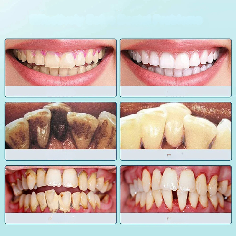 Carvallo tandrenser Plaktrino | tandsten- & belæg fjerner | blid & effektiv | kompakt 10 cm