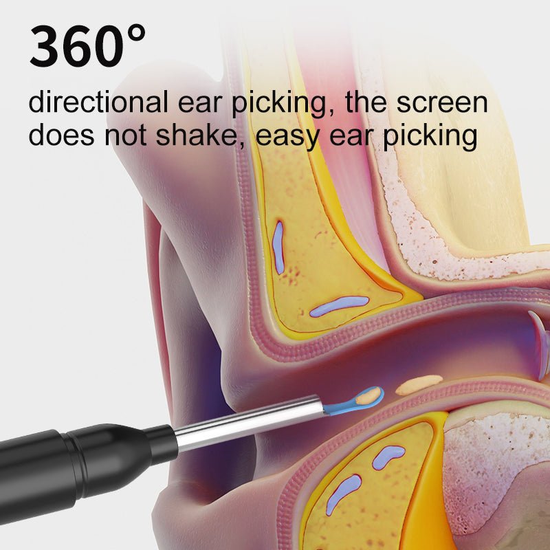AURIVIEW – Intelligent öronrengörare med HD-kamera