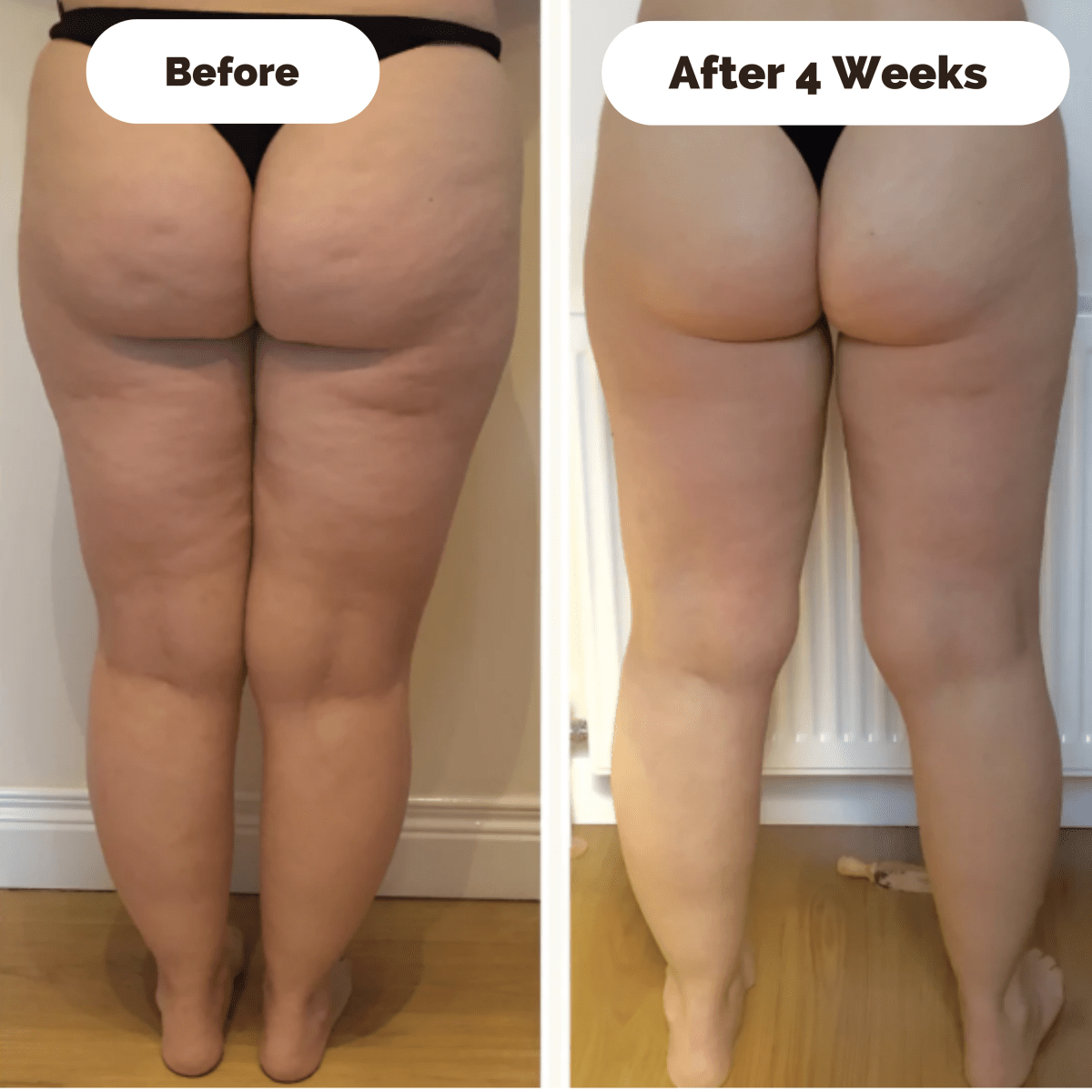 DERMAGLOW – Huduppstramande massageapparat mot celluliter