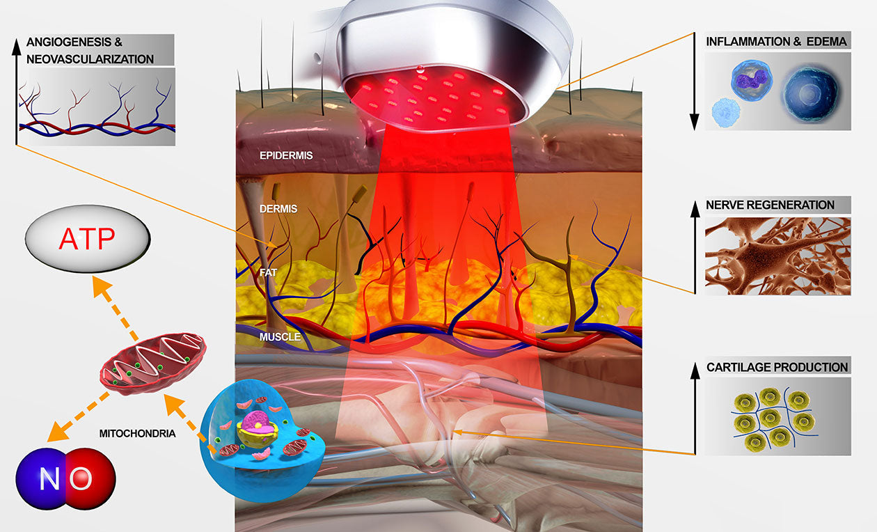 Uppgraderad Kalla Laser Röd Ljus Terapi Enhet