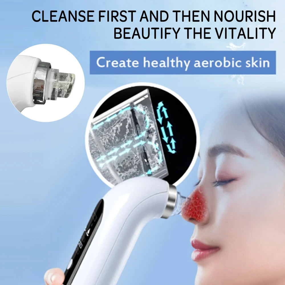 Uppdaterad Blackhead Remover Pore Vacuum