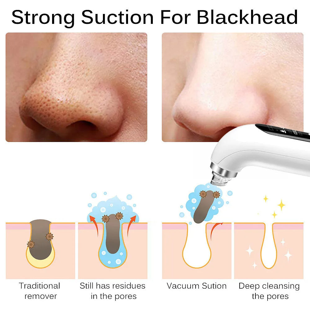 Uppdaterad Blackhead Remover Pore Vacuum