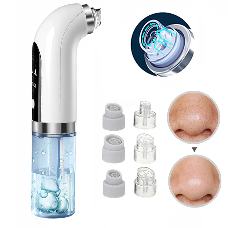 Uppdaterad Blackhead Remover Pore Vacuum