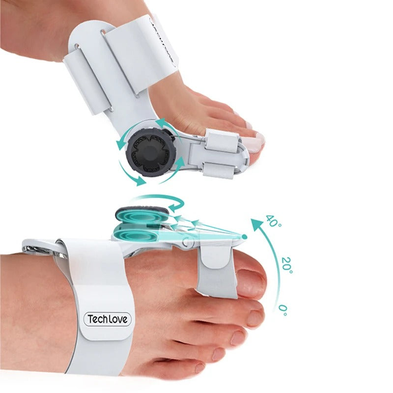 Uppgraderad Tå Bunion Korrigerare – Justerbar Ortopedisk Splint för Smärtlindring &amp; Alignment