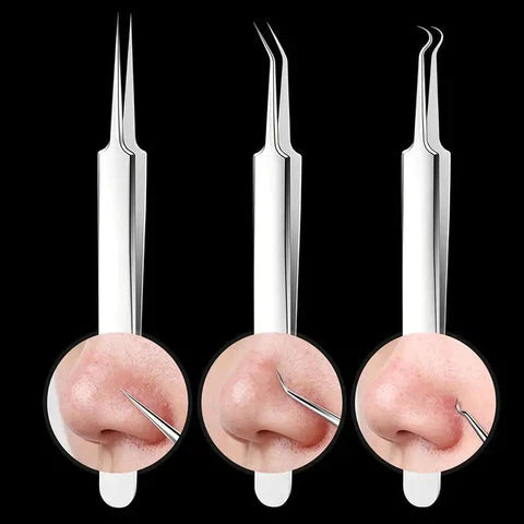 Luxora Svartprick Tång - Anti Svartprick Kit Set 3 Pcs