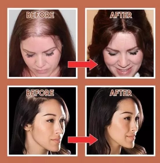 Royallure Natural Look Hår Toppklipp för Tunnande Hår