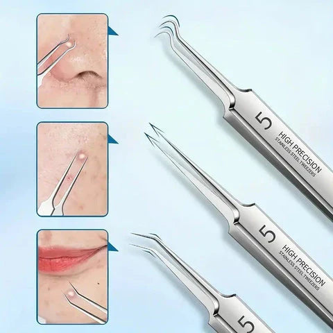 Luxora Svartprick Tång - Anti Svartprick Kit Set 3 Pcs