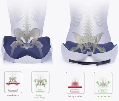 SITRELIEF – Justerbart sittkudde av minnesskum för svanskota- och ryggstöd