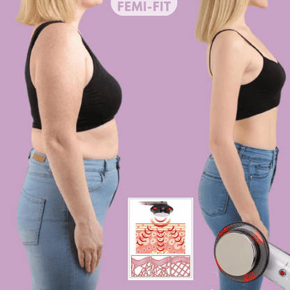 Slimshape - 3-i-1 Cellulite &amp; Fettförbrännare med EMS, Ultraljud &amp; Infraröd