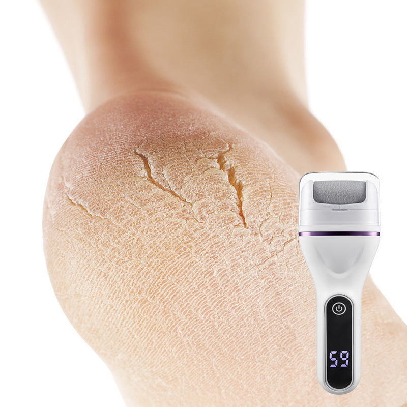 Carvallo Pro – För sammetsmjuka fötter på minuter