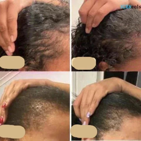 Veganskt hårväxtolja | Naturlig booster för sunt hårväxt